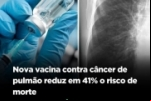 Nova vacina contra câncer de pulmão reduz em 41% o risco de morte