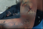 Jovem é alvo de tentativa de homicídio por negar ter relação com aniversariante em Porto Velho